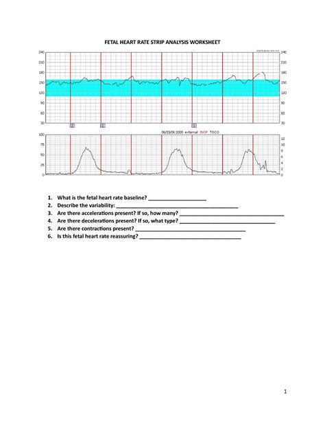 fetal monitoring strips practice